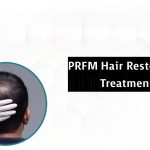 Reasons Why You Should Get a PRFM Hair Restoration Treatment
