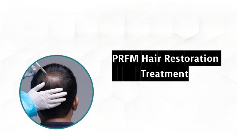Reasons Why You Should Get a PRFM Hair Restoration Treatment