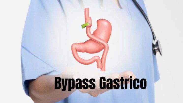 What Pain Reliever Can I Take With The Bypass Gastrico