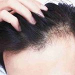 How to Increase Hair Growth in Men