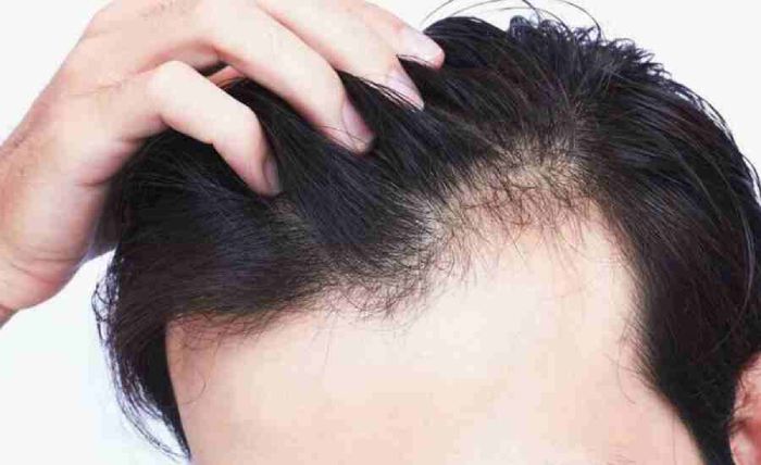 How to Increase Hair Growth in Men