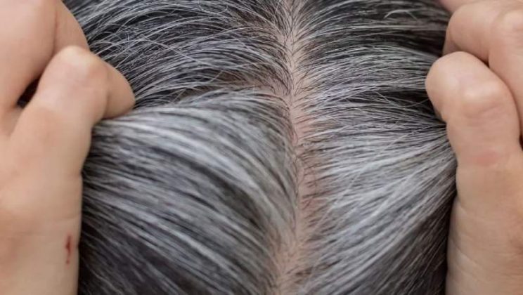 White Hair Treatments Using Natural Ingredients