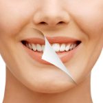 4 Strategies to Get the Desired Gorgeous, Natural-Looking Smile