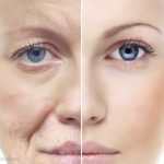 Top 3 Strategies to Prevent Skin Ageing